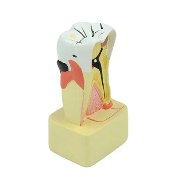 Прямая поставка стоматологической модели для анализа пародонта для стоматологической клиники, обучающей стоматологов